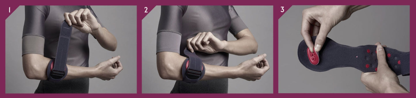 Epicondylitis Orthopedic Bracelet